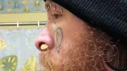 په پوزه کې تر ټولو د ستر سوري ریکارډ