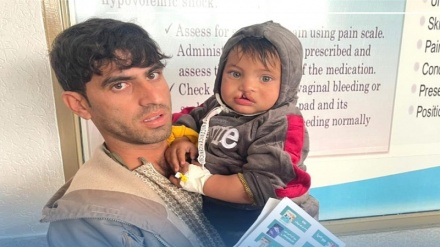 درمان رایگان کودکان لب‌چاک و کام‌چاک در افغانستان از سوی یک پزشک افغان