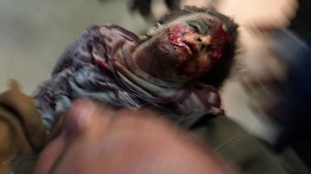 Siyonist soykırımda şehit edilenlerin sayısı 24 bin 285, yaralı sayısı 61 bin 154'e ulaştı