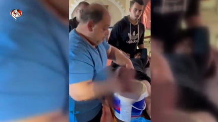 Yaralı kızının bacağını anestezisiz kesmek zorunda kalan Filistinli doktorun gözyaşları
