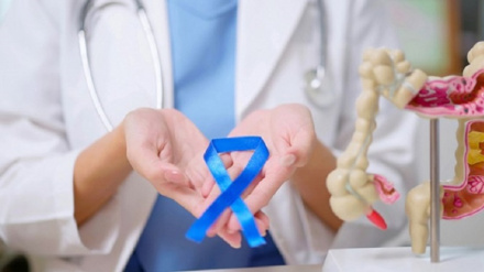 Диагностика рака толстой кишки с помощью иранский нанотестов