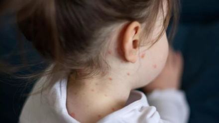 ۶ لکه افغان ماشومانو ته د شري واکسن ولګول شول