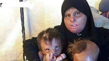Filistinli kadınların ve sivillerin İsrail tarafından yakılması, Amerika'nın Japonya'da cinayetlerini örnek alıyor