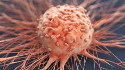伊朗研究者发明治疗癌性肿瘤的纳米制剂