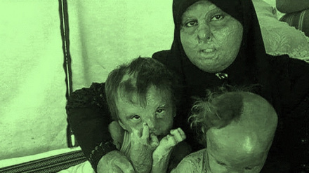 इस्राईल द्वारा आम फिलिस्तीनी नागरिकों को जलाया जाना, जापान में अमेरिका की तरह जलाये जाने का नमूना