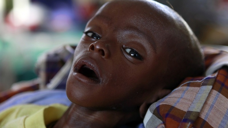 بحران سازی جدید غرب برای نظام بهداشت آفریقا / مهاجرت دادن پرستاران کشورهای فقیر