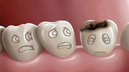 ۵ ماده غذایی که سلامت دندان ها را تهدید می‌کند