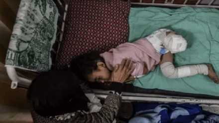  ۱۰ کودک در غزه هر روز پاهایشان را از دست می‌دهند