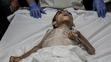 Carestia a Gaza, oltre 3.500 bambini a rischio di morte