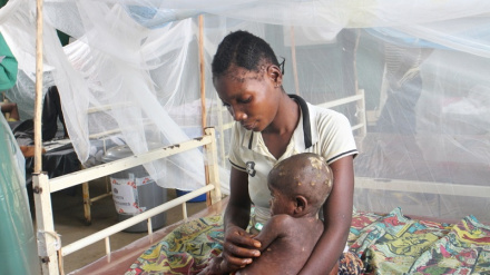 Jamhuri ya Kidemokrasia ya Congo yatahadharisha kuhusu ongezeko la MPOX