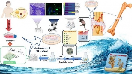 Iranian researchers introduce new treatment method for bone repair