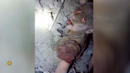 Daktari Myahudi awaumbua Wazayuni kwa jinai zao dhidi ya watoto wa Palestina