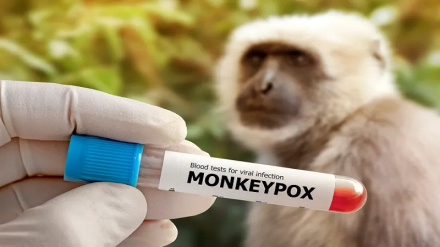 Shirika la Afya Dunia (WHO): Mpox sio 