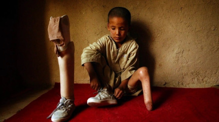 Watu milioni 1.5 ni walemavu nchini Afghanistan kutokana na mlipuko wa mabaki ya zana za kivita 