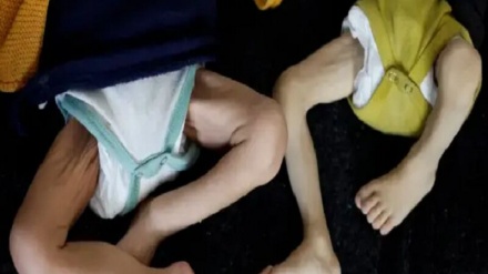 مرگ کودکان غزه؛ نتیجه محاصره و جنایت سازمان‌یافته رژیم صهیونیستی