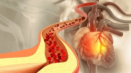 خوراکی‌هایی که به طور طبیعی کلسترول بد را کاهش می‌دهند