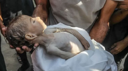 شهادت ۱۲۷ نفر بر اثر سوء‌تغذیه در باریکه غزه