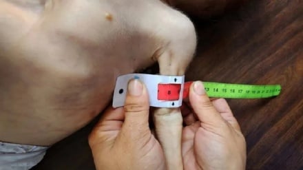 גינוי בינלאומי למדיניות הרעבה בעזה: ישראל מבצעת רצח עם שיטתי בתמיכת ארה