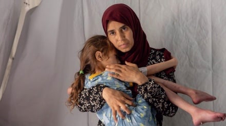 L’UNRWA alerte sur une hausse inquiétante de la malnutrition chez les enfants à Gaza