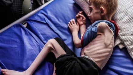 Medici affamati, bambini scheletri; l'Occidente sostiene ancora gli assassini dei bambini di Gaza