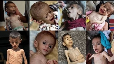 500 Bayi di Gaza Berjuang Melawan Kelaparan dan Malnutrisi