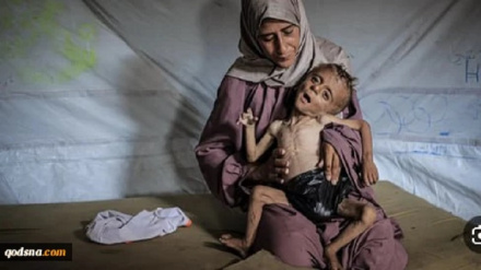 Watoto 20,000 wa Gaza wanatabika kwa utapiamlo mkali 