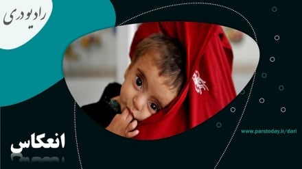 خطر ابتلای میلیون ها کودک به سوء تغذیه در افغانستان  