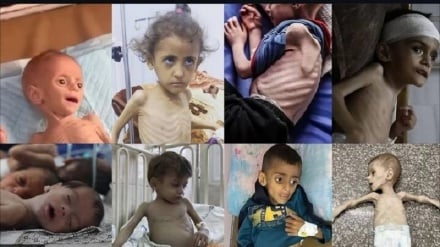 Takwimu za kutisha za watoto wahanga wa njaa na vita Gaza