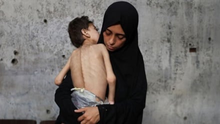 UNICEF: Lebih dari 5.000 Anak Gaza Alami Malnutrisi dalam Dua Pekan 