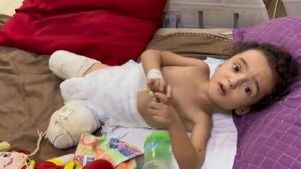 Aumento del 225% delle amputazioni nella guerra di Gaza