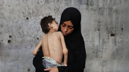 UNRWA’dan Gazze’deki Çocukların Durumuna Dair Uyarı: Açlık Üç Katına Çıktı
