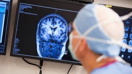 脑部疾病诊断技术随MRI成像升级实现重大突破｜德黑兰大学引领四维打印技术创新前沿