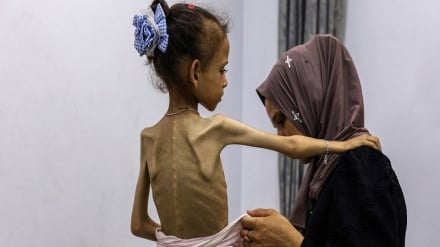 WHO: Watu 400 wameaga dunia kwa utapiamlo Ukanda wa Gaza tangu kuanza mwaka huu