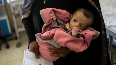 افزایش بحران سوءتغذیه کودکان در بدخشان؛ دهها کودک جان باختند