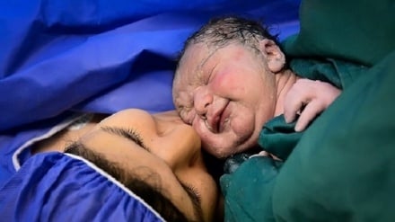 Iran gehört zu den 10 führenden Ländern weltweit bei der Unfruchtbarkeitsbehandlung