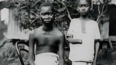 Kongo unter dem Messer Belgiens – Kautschukkolonialismus und Abrechnung mit Menschenhänden