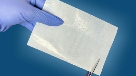 Apósito nanointeligente para heridas hecho en Irán ahorró un millón de dólares en divisas al país
