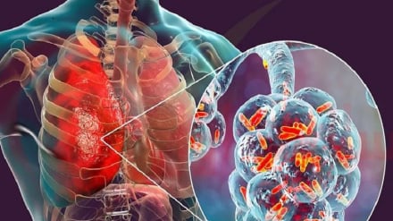 هند په افغانستان کښې د نري رنځ درملنه کوي