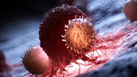 “Tratamiento eficaz y con pocos efectos secundarios del cáncer en Irán mediante tecnología nacional de electroquimioterapia.”