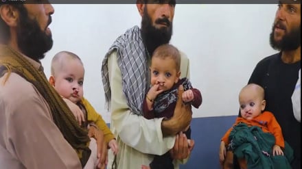 آغاز کمپین رایگان جراحی لب‌شکری و کام‌شکاف در ولایت خوست