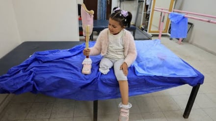 Rreth 8 mijë persona kanë pësuar amputime gjatë luftës në Gaza