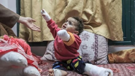 Karibu Wapalestina 8,000 wamekatwa viungo katika vita vya Israel dhidi ya Gaza