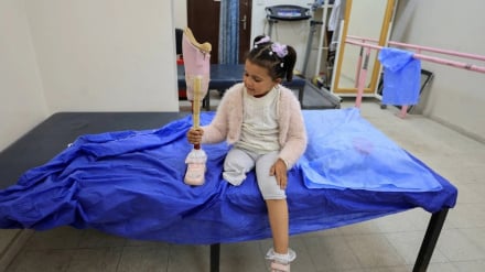 Nearly 8,000 people have lost limbs during Gaza war
