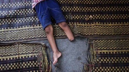 Ripoti: Watu 8,000 wamekatwa viungo tangu kuanza kwa vita dhidi ya Gaza