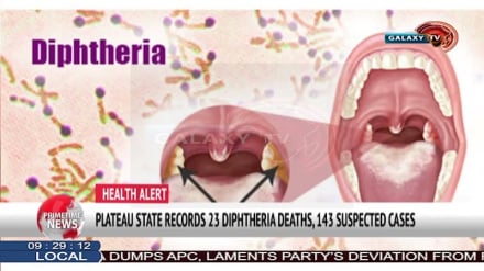 Jimbo la Plateau nchini Nigeria lafunga shule kutokana na mlipuko wa Diphtheria