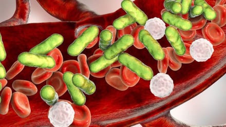Prodhimi i një kompleti nanoteknologjik iranian për zbulimin e bakterit që shkakton kancerin e stomakut